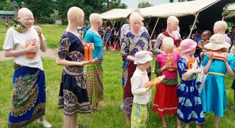 People with Albinism still ‘living in fear’ in Malawi