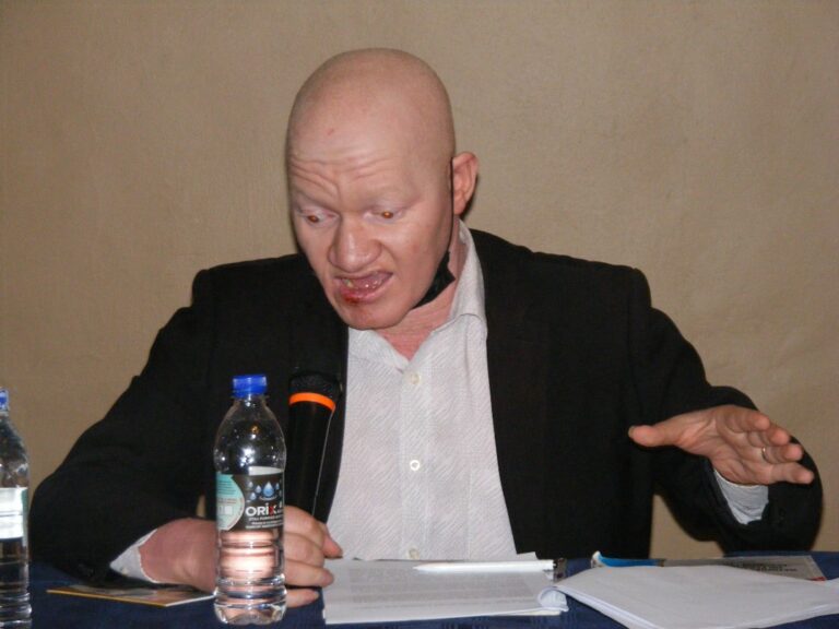 We Are Tired of Living in Fear- Albinos